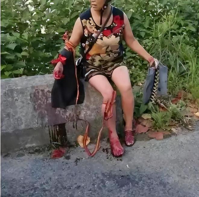 咬身亡!身材一绝是家中独生女肤白貌美太可惜j9九游真人游戏第一平台27岁女游客被蛇(图5) 咬身亡!身材一绝是家中独生女肤白貌美太可惜j9九游真人游戏第一平台27岁女游客被蛇(图5)